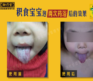  ������ˎԡ�eʳ����������̦ 1