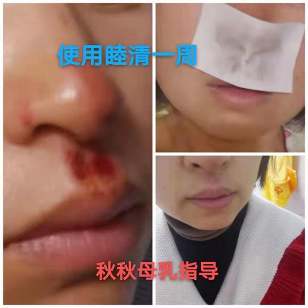 �����澏���N���Æ������M(f��i)�߿ڱ���������(sh��)���a(ch��n)ƷȦ�۟o��(sh��)